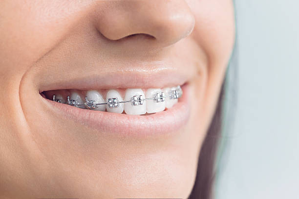 Best Dental Exams and Cleanings  in Aberdeen, IN